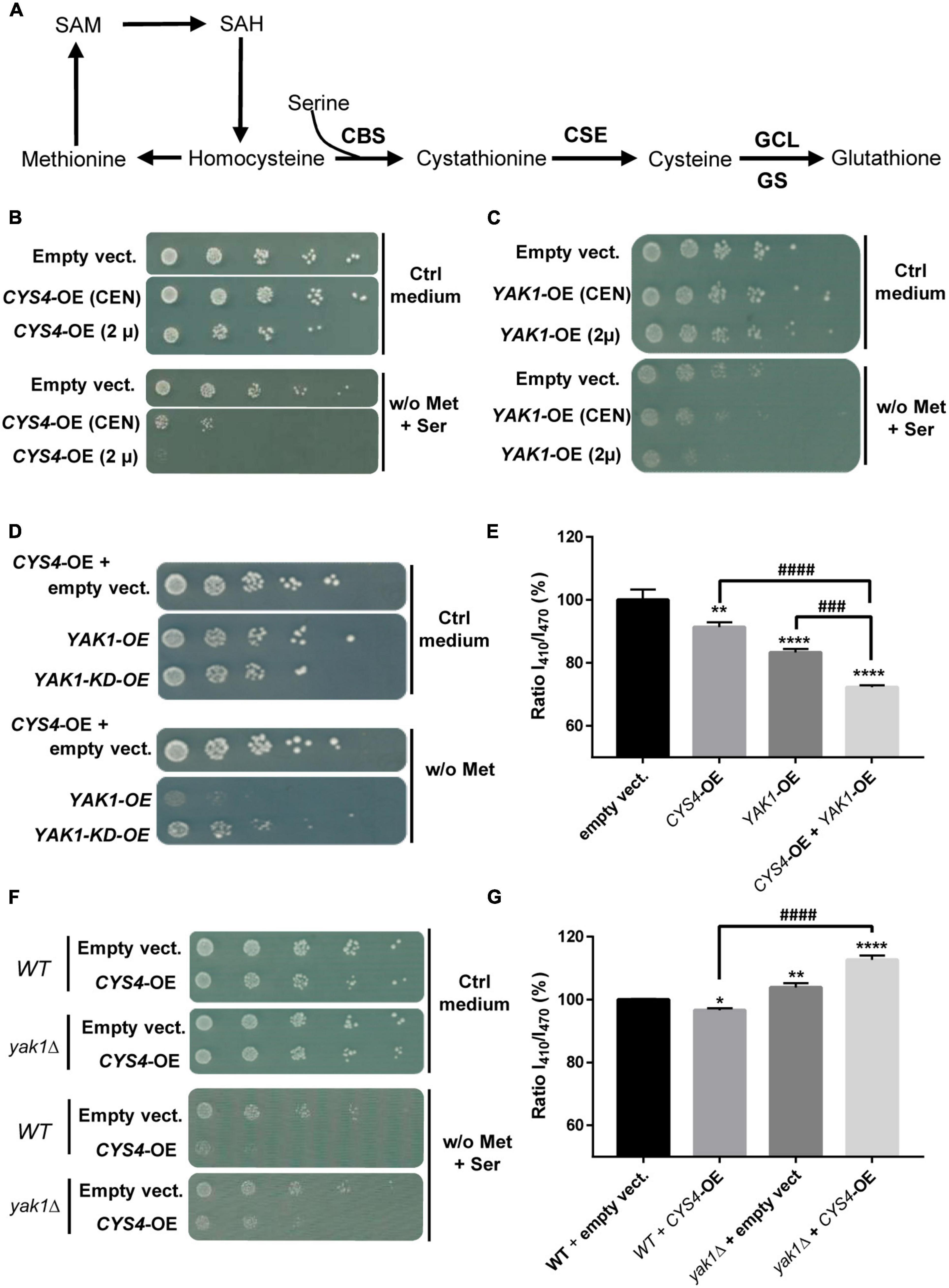 New insights into the regulation of Cystathionine beta synthase (CBS), an enzyme involved in intellectual deficiency in Down syndrome